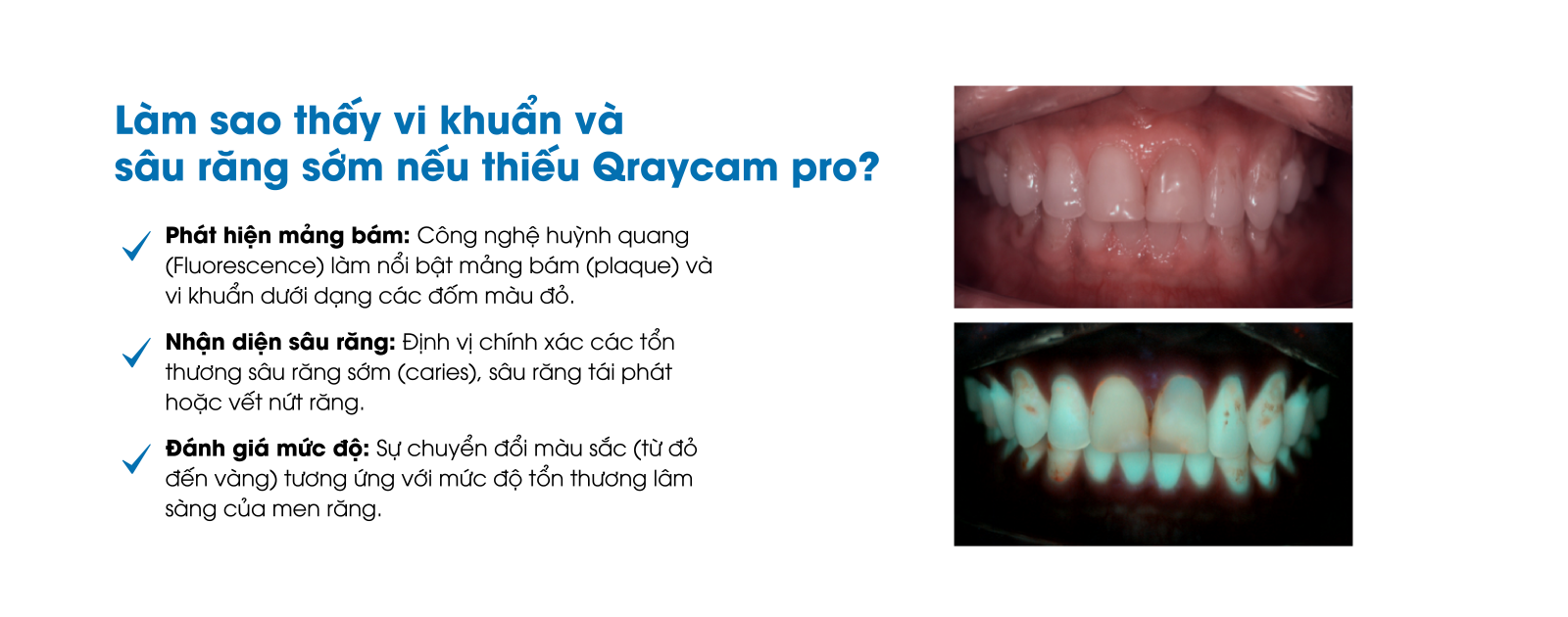 Qraycam pro